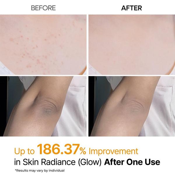 「PEEL SHOT」Face + Body Dual System Dr.Melaxin