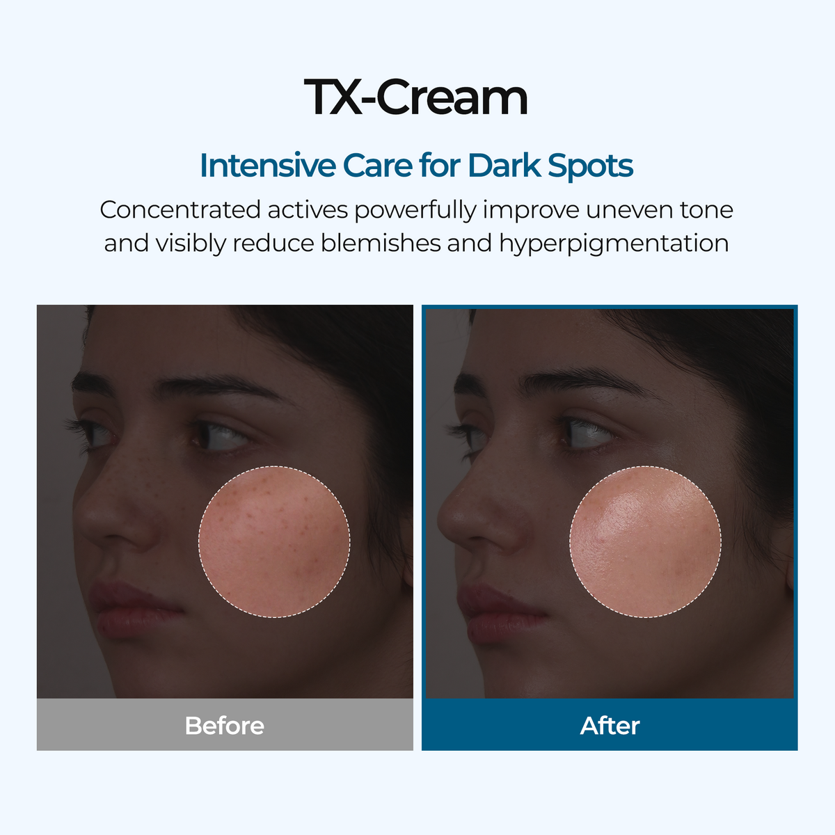 TX Cream Dr.Melaxin