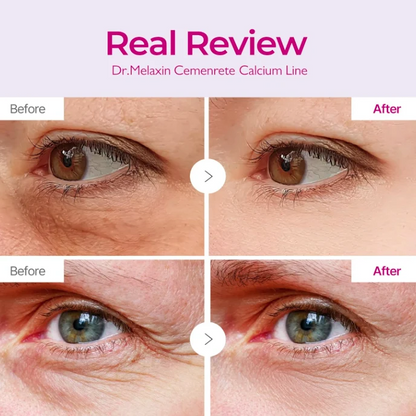 Dr. Melaxin Cemenrete Calcium Volume Eye Patch Dr.Melaxin