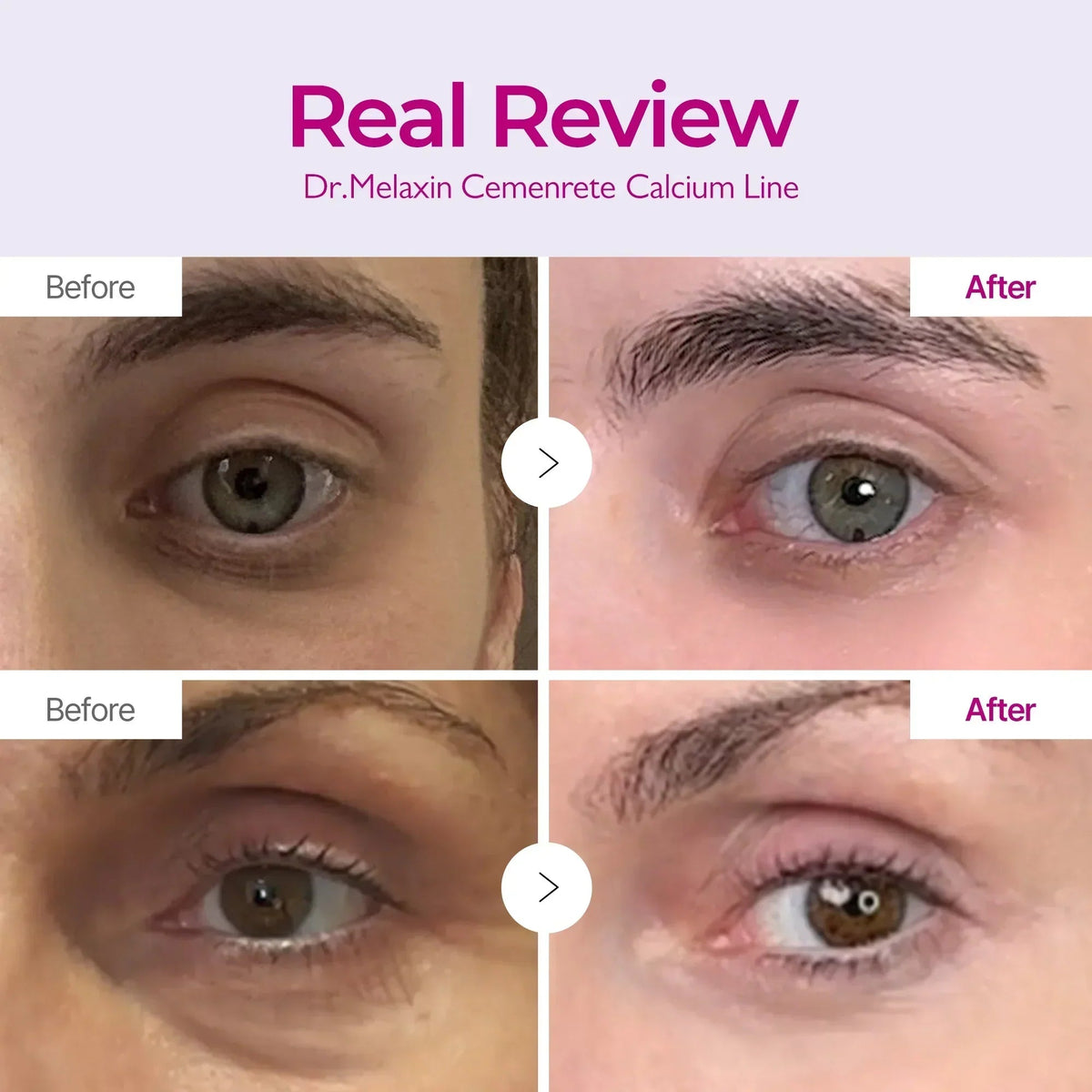 Cemenrete Calcium Intense Cream Dr.Melaxin