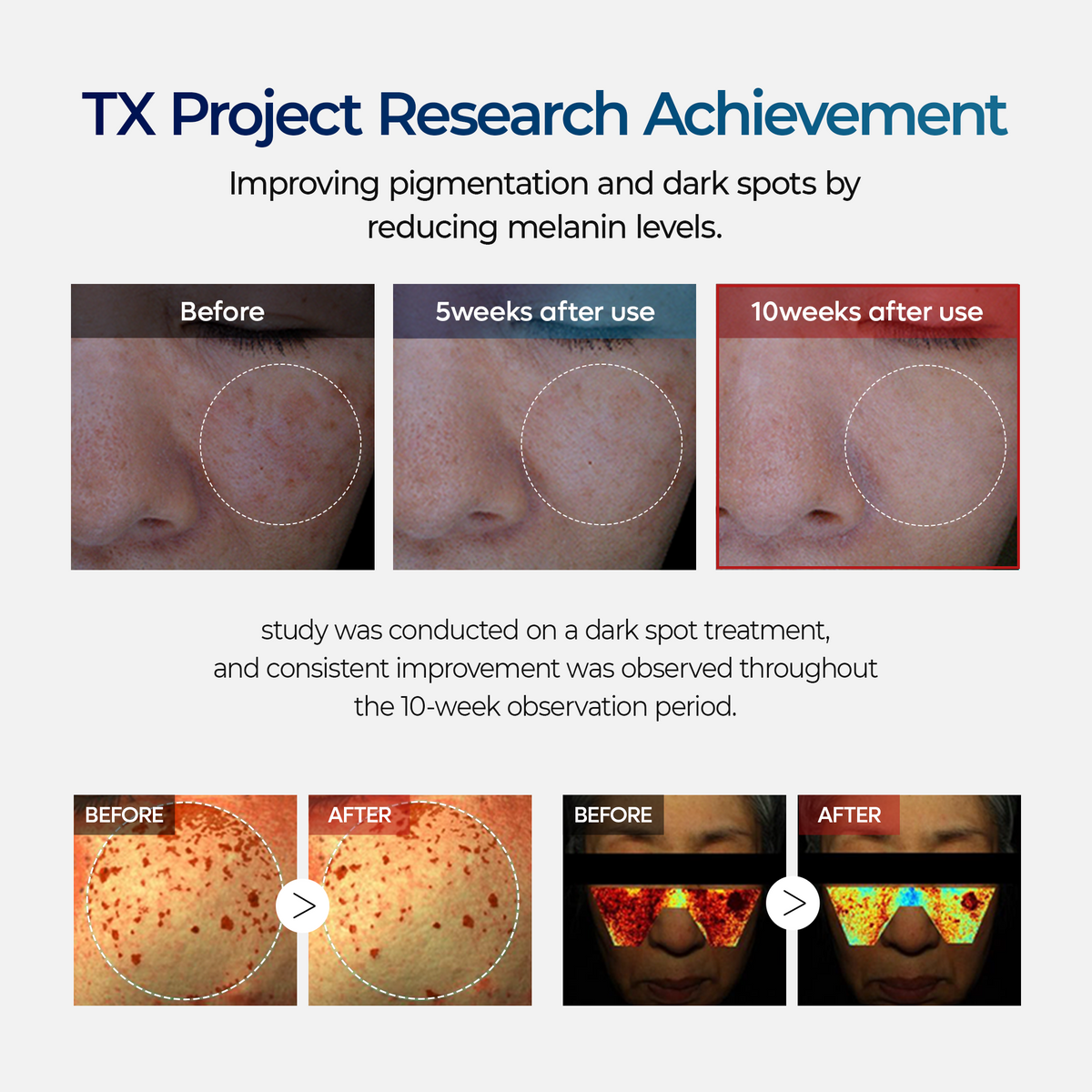 TX Cream Dr.Melaxin